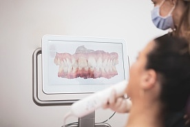 Pijmme data z intraorlnch scanner